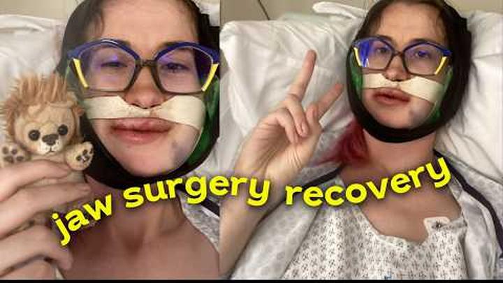 A life update after my jaw surgery �