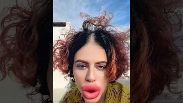 ��