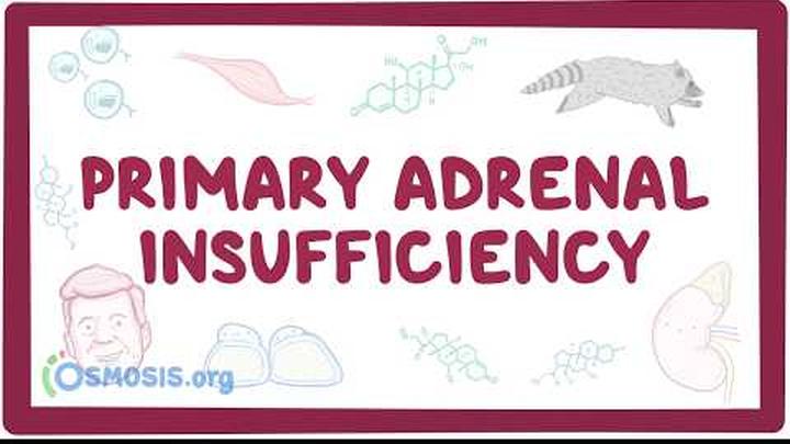 Primary adrenal insufficiency - pathology, symptoms, diagnosis, treatment