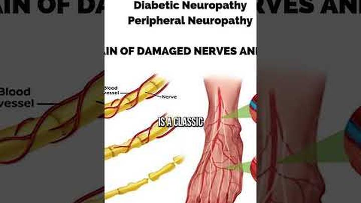 Alcohol & Vitamin B1 Deficiency �