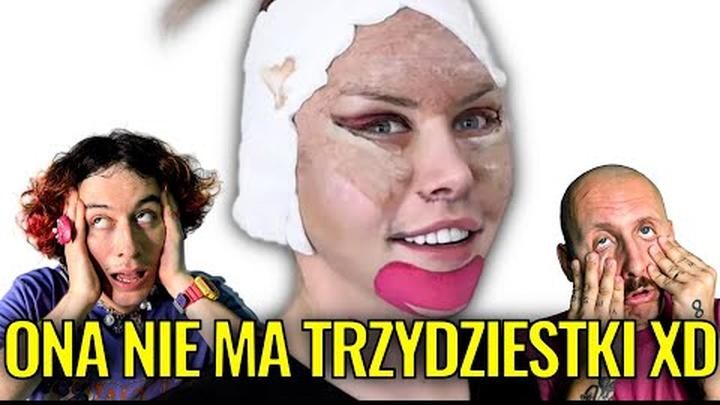 29-LETNIA JULIA VON STEIN JUŻ PO LIFTINGU